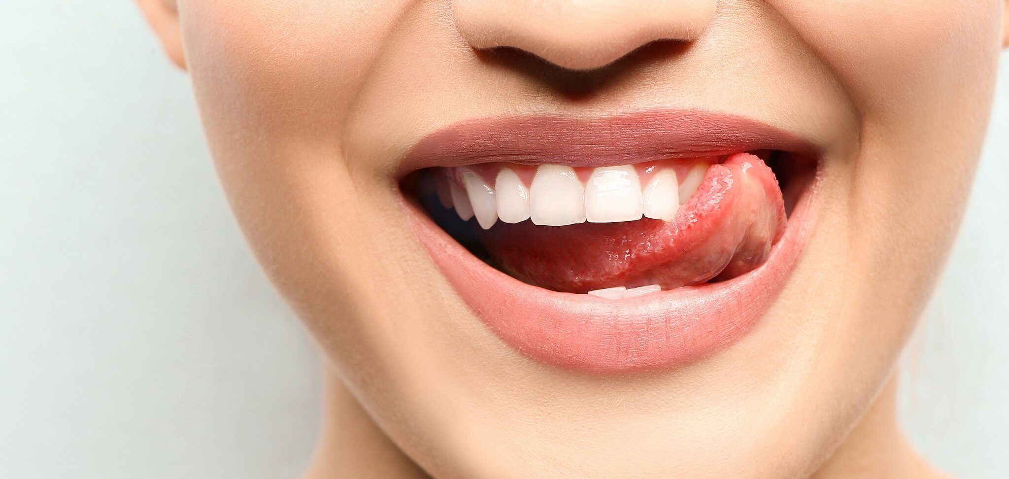 5773786_weisse-zaehne_4483185-00