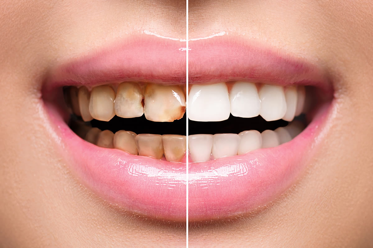 aesthetische-zahnmedizin-2