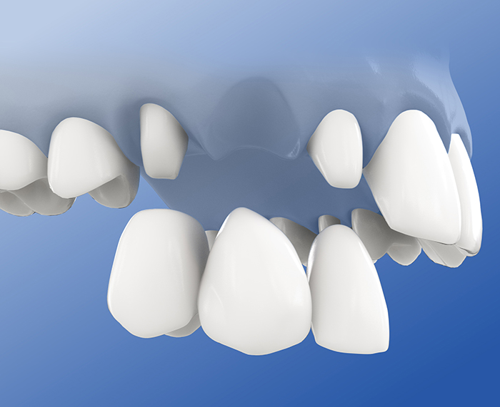 43_endpfeilerbruecke_700