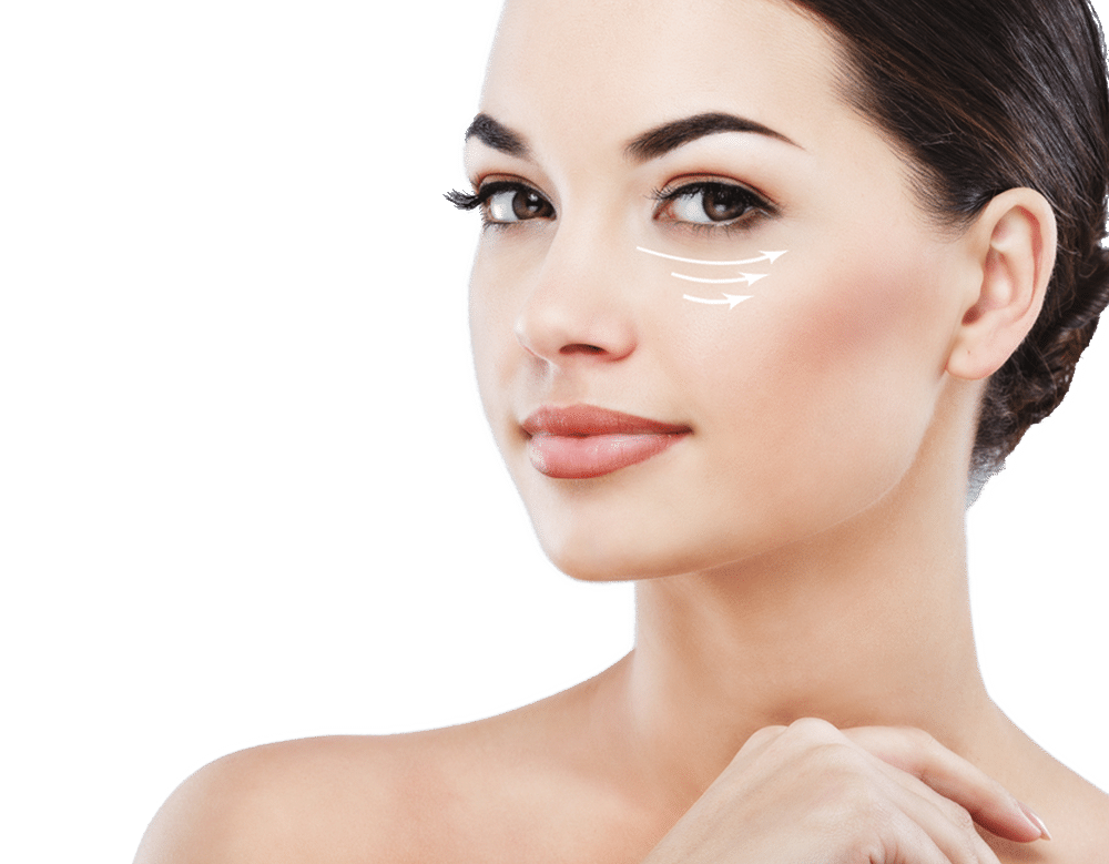 Tränensäcke-entfernen