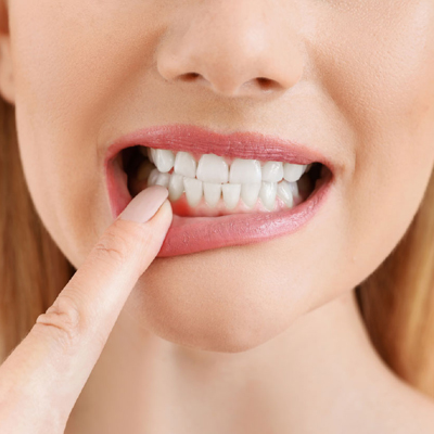 zahnfleischentzuendung-feststellen