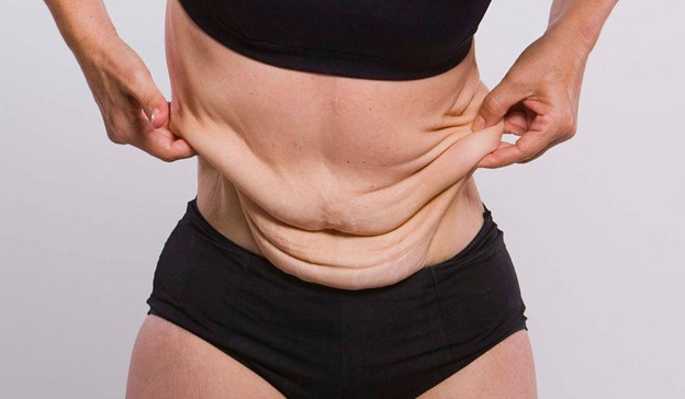 تكميم_المعدة